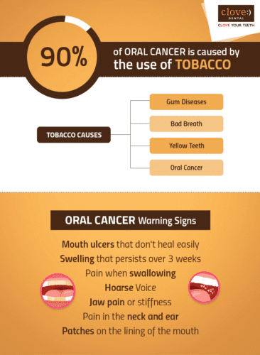 Oral Cancer is Caused by the Use of Tobacco