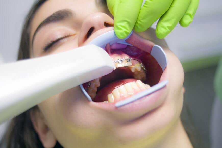 COMMON DENTAL ISSUES