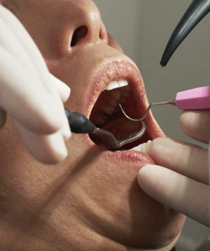 Health Dangers Of Crowded Teeth