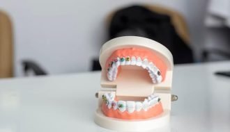Why Invisalign is the Most Comfortable Way to Straighten Your Teeth
