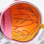 Cataract-Surgery