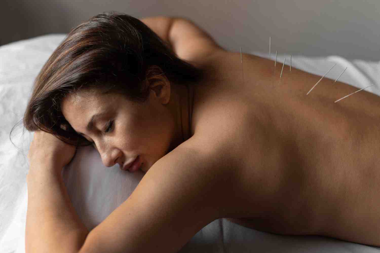 Acupuncture in Ottawa